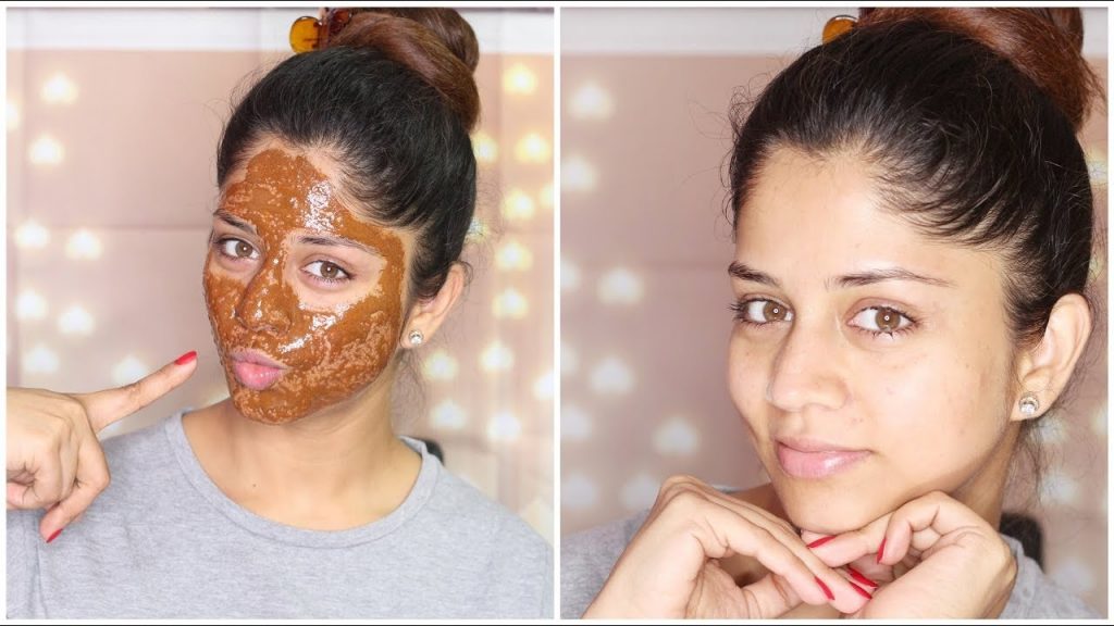 solutions for acne: Make a honey and cinnamon mask